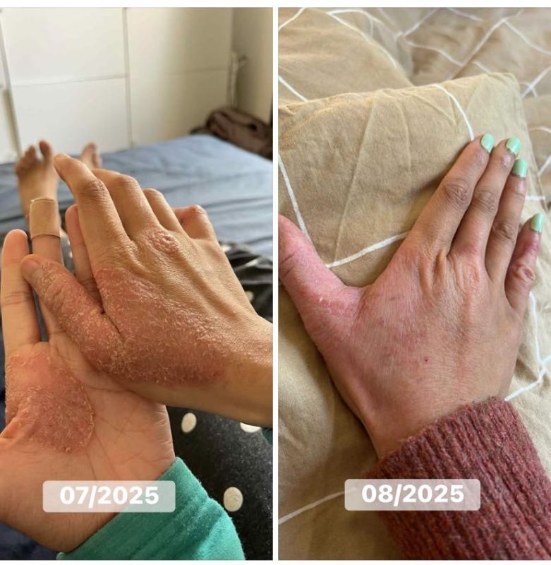 reiki giảm stress và lo âu, how reiki helps to reduce stress and anxiety